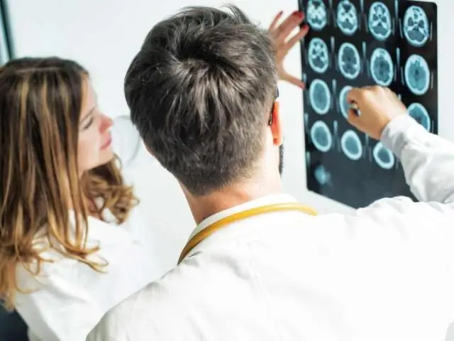 Обсессивно-компульсивное расстройство (ОКР) Симптомы: 10 признаков того, что оно у вас есть