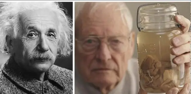 Что такое флорид? Кому противопоказан стоматологический фтор? Каковы риски?