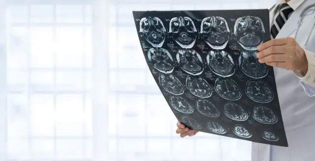 Осложнения, связанные с центральным преждевременным половым созреванием