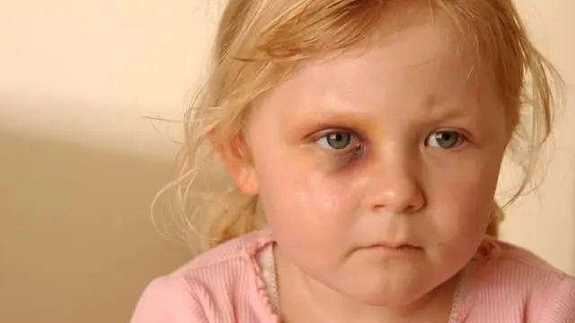 Что делать, если над вашим ребенком издеваются