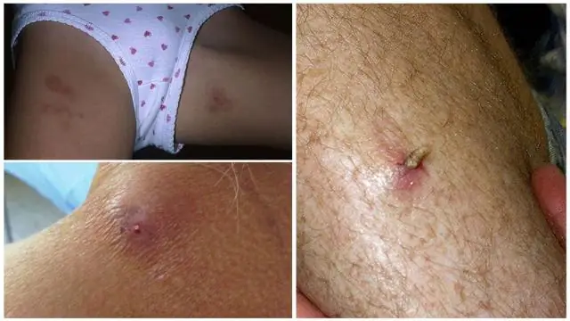 Проникновение в шейку матки: что это такое и почему люди это делают