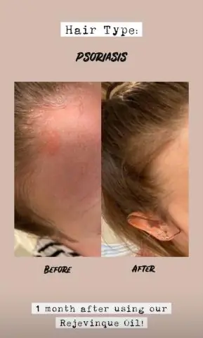 Псориаз и знакомства