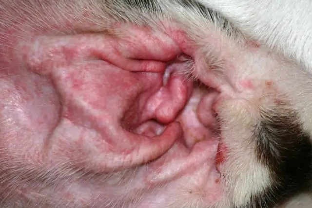 Фототерапия при атопическом дерматите