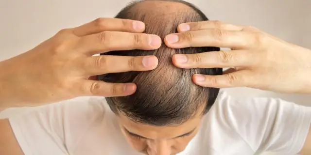 Medications & Препараты, вызывающие выпадение волос