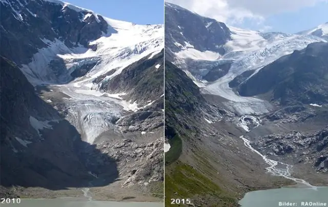 Сравнение методов лечения апноэ во сне