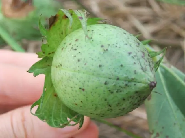 Эндометриоз: какие бывают виды и стадии?