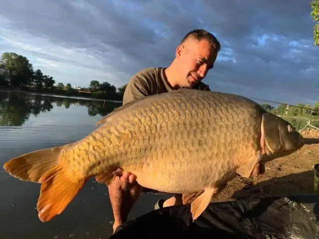 Есть ли у меня риск развития миомы?