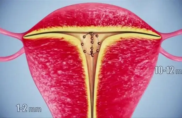 Есть ли нервы в матке?