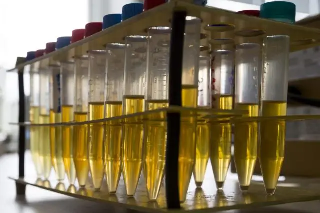 Что вызывает повышенный уровень белка в моче?