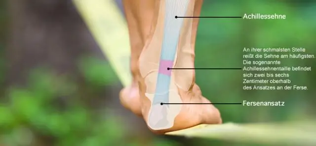 Насколько прочно ахиллово сухожилие?