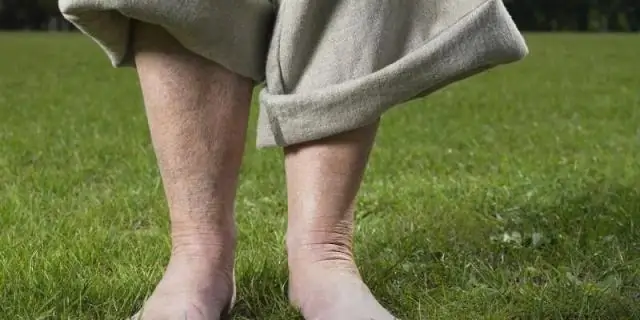 Покрывается ли janumet страховкой?