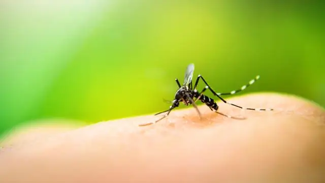 Что происходит с вашим телом, когда вы теряете сознание?