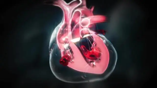 Помогает ли нитроглицерин при сердечном приступе?