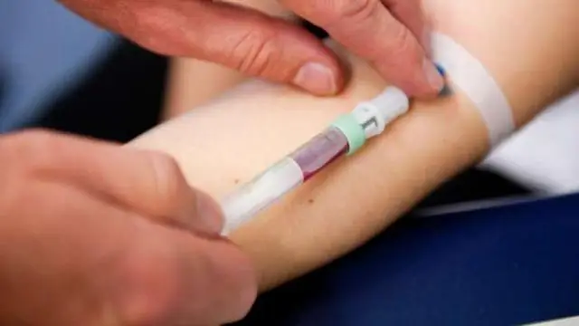 Какие виды рака можно обнаружить с помощью анализа крови?