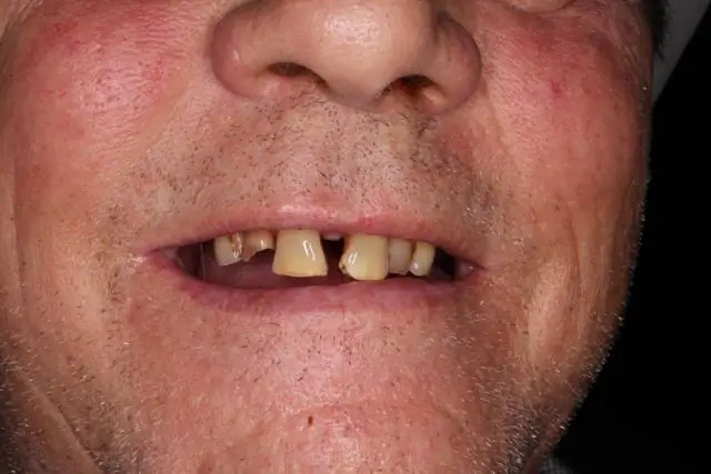 Халазионы вызваны стрессом?