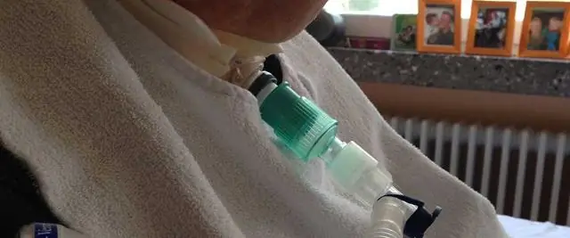 Можете ли вы спать с клапаном Пасси Мюира?