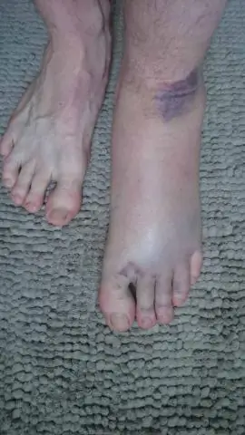 Как долго длится цикл яичников?