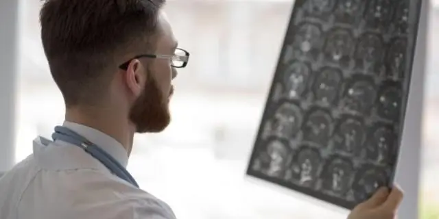 В чем разница между спинномозговым нервом и периферическим нервом?