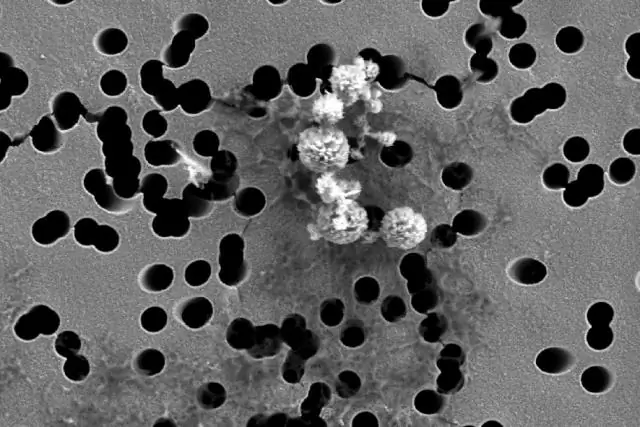 3D визуализация поглощения внеклеточных пузырьков эндотелиальными клетками