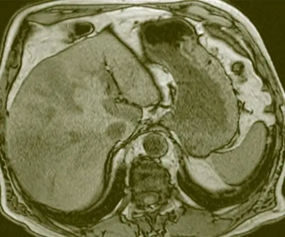 Выходные влияют на риск смертности и вероятность выписки у критически больных пациентов: ретроспективное исследование в австрийском реестре интенсивной терапии