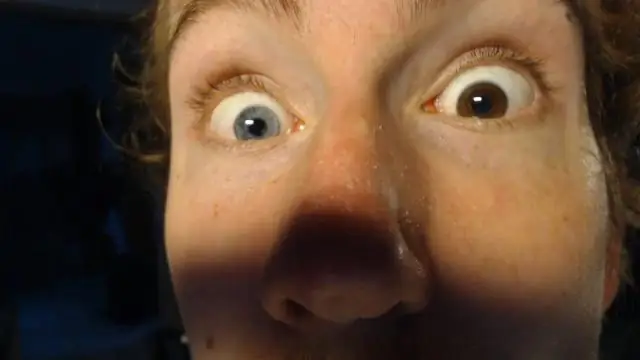 Различная связь потребления алкоголя с различными типами инсульта: систематический обзор и метаанализ