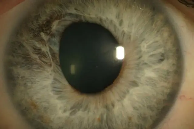 Висцеротропная болезнь и острый увеит после вакцинации против желтой лихорадки: история болезни