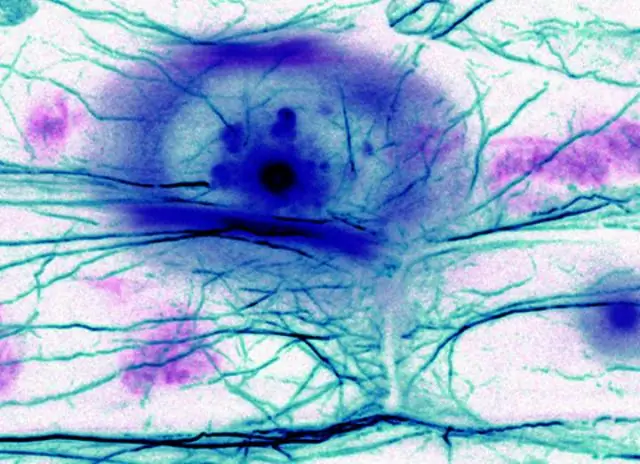 Молекулярная эпидемиология, генетическая изменчивость и эволюция HTLV-1 с особым акцентом на африканские генотипы