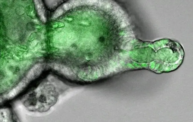 Низкая распространенность мутации BRAF V600 при первичной меланоме кожи в Индонезии: обнаружение ПЦР в реальном времени среди яванских пациентов