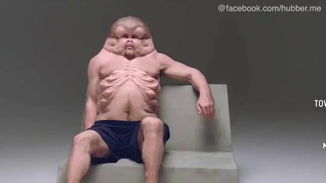 Автоматическая и ручная настройка роботизированной тренировки походки у людей с неврологическими расстройствами