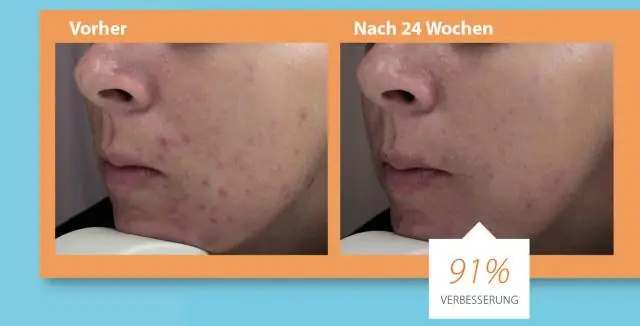 Модель одноранговой поддержки для улучшения качества жизни среди особо уязвимых пожилых людей с низким уровнем дохода в Кейптауне, Южная Африка