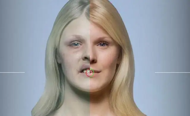 Сильное влияние программы условных денежных переводов Эквадора на детскую смертность от болезней, связанных с бедностью: общенациональный анализ