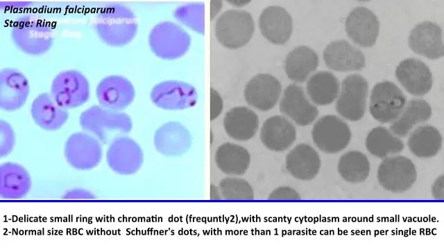 Изменяющийся ландшафт лекарственной устойчивости Plasmodium Falciparum в Демократической Республике Конго