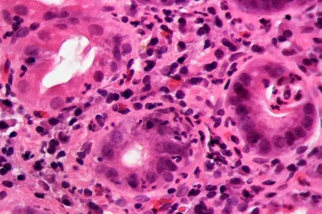 18S рРНК плазмодия внутривенно вводимых спорозоитов не сохраняется в периферической крови