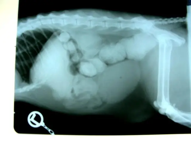 Заболевания нервной системы: ретротранспозонная активность при нейродегенеративных заболеваниях