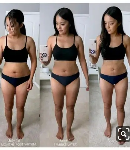 Чрезмерный синтез фолиевой кислоты ограничивает продолжительность жизни в модели старения C. Elegans: E. Coli