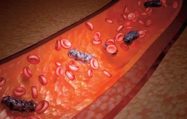 Метагеномика для выявления патогенов в общественном здравоохранении