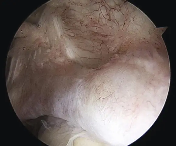 Презентации взрослых пациентов с сепсисом в догоспитальном периоде по данным служб скорой медицинской помощи: анализ смешанных методов