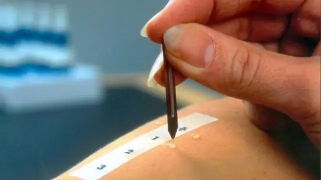 Элиситоры и кофакторы в пищевой анафилаксии у взрослых