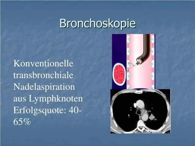 Интерстициальные заболевания легких у госпитализированного больного