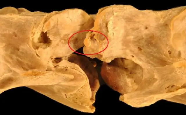 Свидетельство изменений сократительных свойств скелетных мышц во время начала заболевания на модели остеоартрита у стареющих морских свинок