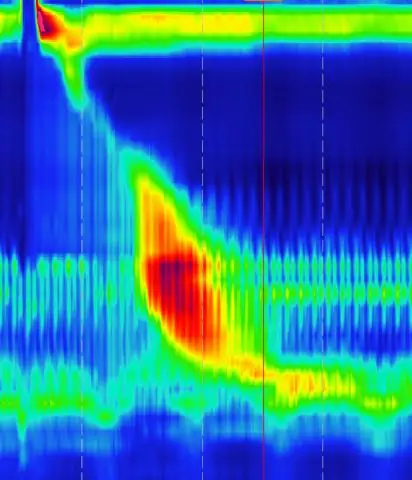 Распространенность и особенности мультиморбидности среди больных туберкулезом в Бразилии: перекрестное исследование
