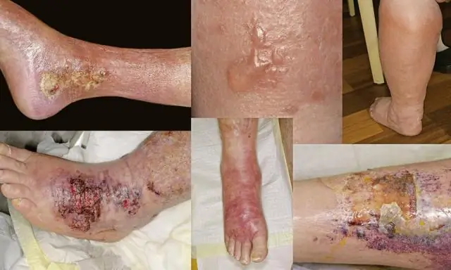 О распространенности и распространенности жестокого обращения с детьми: программа исследований