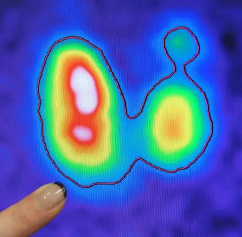 Изучение областей удовлетворенности и мотивации медсестры сообщества: результаты смешанной базовой оценки в сельской Гане