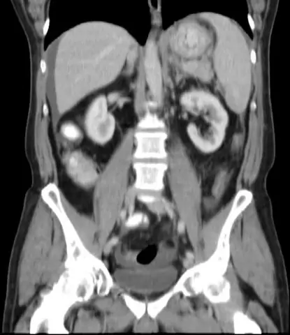 Максимальное распространение вакцинации против гриппа среди медицинского персонала в Израиле: уроки, извлеченные из политики обязательной вакцинации в Соединенных Штатах
