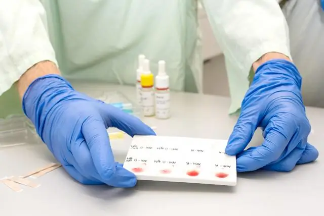 Распознавание болезней, принятие решений и поиск помощи при осложнениях у матери и новорожденного: качественное исследование в районе Сарлахи, Непал