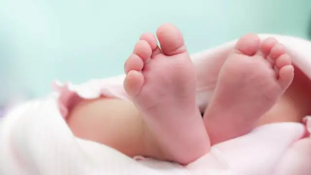 Метилмалоновая и пропионовая ацидемия среди госпитализированных педиатрических больных: общенациональный доклад