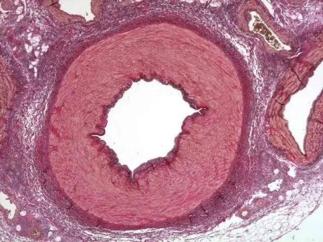 Уровни микрочастиц эндотелия, тромбоцитов и макрофагов резко не меняются после транскатетерной замены аортального клапана