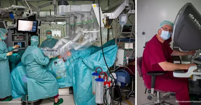 Краткосрочные результаты лапароскопической межфинктерной резекции с интраоперационной лучевой терапией с использованием низкоэнергетического рентгеновского излучения для первичного