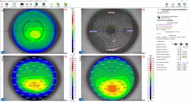 Влияние владения собаками на объективные показатели свободноживущей физической активности и сидячего поведения у пожилых людей, проживающих в сообществе: продольное исследование с