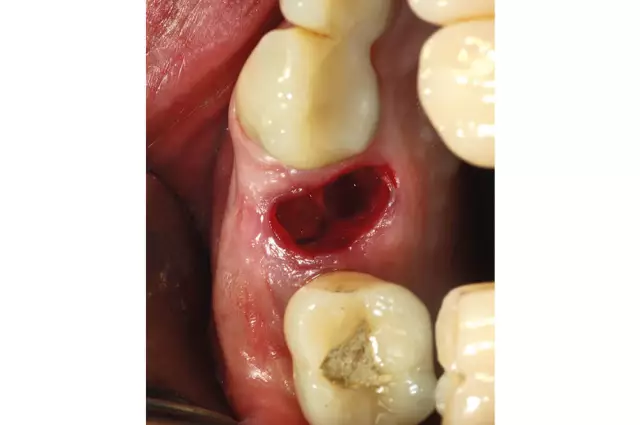 Эффективность новой пероральной жевательной таблетки, содержащей сароланер, моксидектин и пирантел (Simparica Trio ™), против естественного заражения блохами и клещами собак, предс